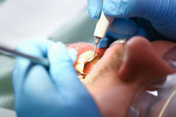 Best Broken Tooth Emergency  in Ashton, ID