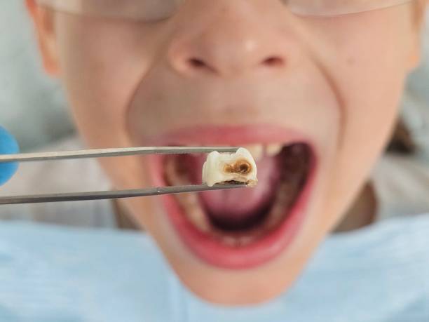 Best Dentist for Dental Trauma  in Ashton, ID